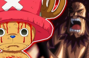 One Piece: Chopper chính là 