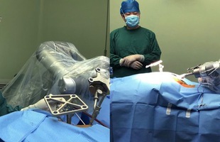 Robot Trung Quốc thực hiện ca phẫu thuật thành công trên cơ thể người, mở ra một tương lai mới cho toàn thế giới